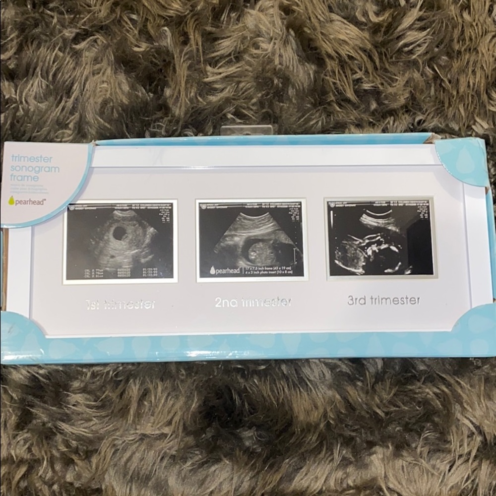 trimester sonogram frame - brand new